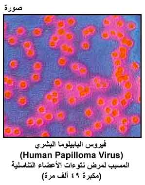 humán papillomavírus vakcina gardasil mellékhatásai