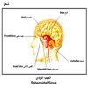 ����� ������ Sphenoidal Sinus
